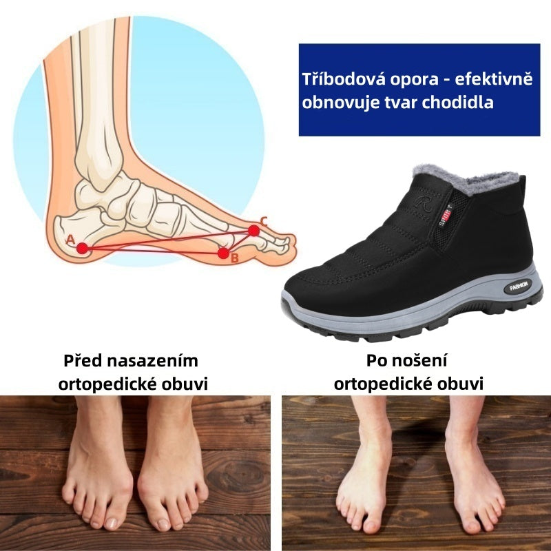 genettech® - Ergonomski zimski ortopedski čevlji za bolečine v stopalih, kolenih in hrbtu - Unisex