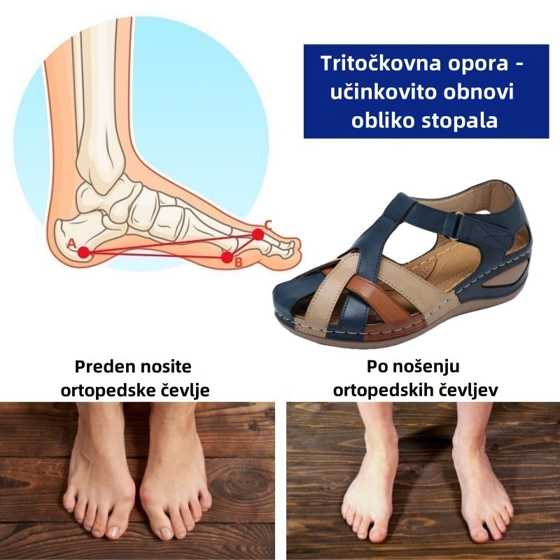 🔥Časno omejen 50 % popust! Poletni ortopedski sandali, ergonomsko oblikovani za udobje in lajšanje bolečin✅