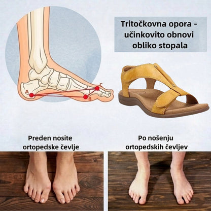 🔥Časno omejen 50 % popust! Poletni ortopedski sandali, ergonomsko oblikovani za udobje in lajšanje bolečin✅