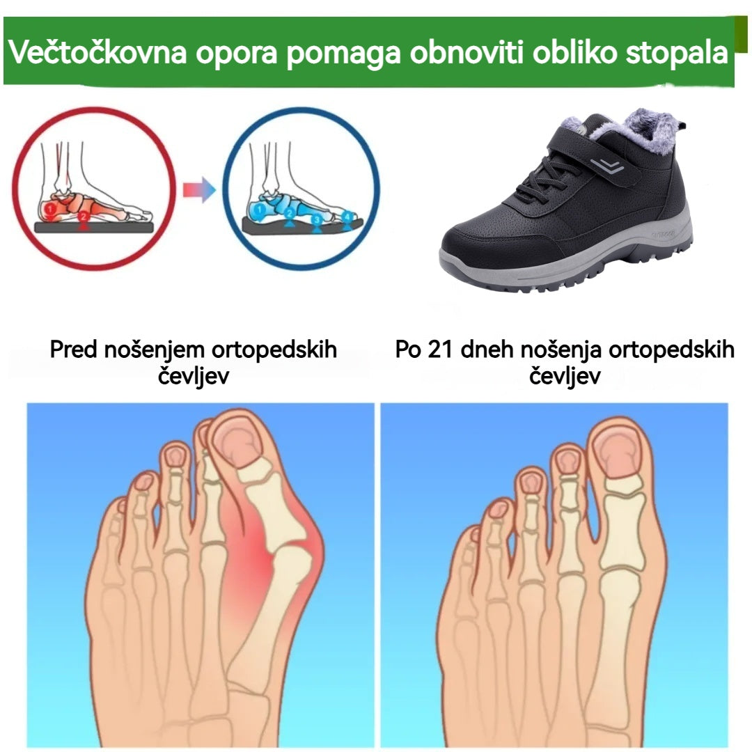 🔥Črni petek: 50 % popust!⏰ - Zimski ortopedski čevlji genettech®, 👞 Nedrseči in topli - Udoben kroj - Ergonomska oblika. (Unisex)