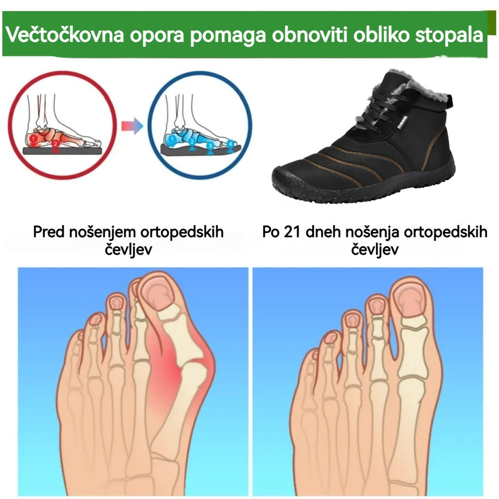 (🔥50 % popust danes - ⏰Ne zamudite!) - Mehki in udobni snežni škornji genettech® (z oporo za stopalni lok - olajšajo hojo)