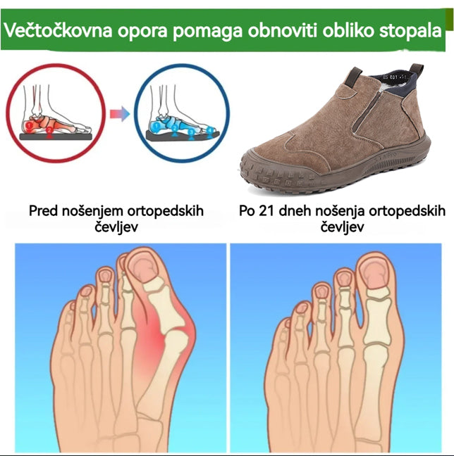 genettech® - Ergonomski zimski ortopedski čevlji za bolečine v stopalih, kolenih in hrbtu - Unisex