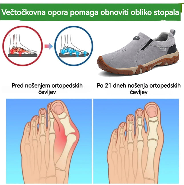 (🔥50 % popusta danes - zgrabite ga!) Vrhunski elegantni ortopedski čevlji 👞 - ergonomska oblika za lajšanje bolečin