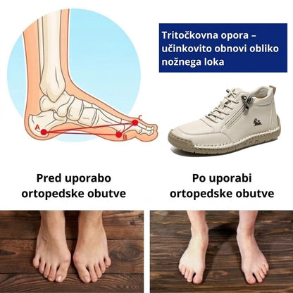 Zadnji dan! 70 % popust! ✅ Ortopedski medicinski čevlji, zasnovani posebej za ljudi s težavami z nogami – učinkovito lajšajo bolečine v hrbtu, sklepih in stopalih.
