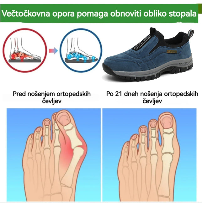 🔥Časovno omejen 50 % popust, najbolj priljubljeni ortopedski čevlji leta 2025, 3 dni za lajšanje bolečin v stopalih